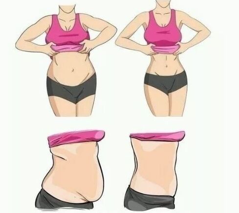 Loss of weight stomach